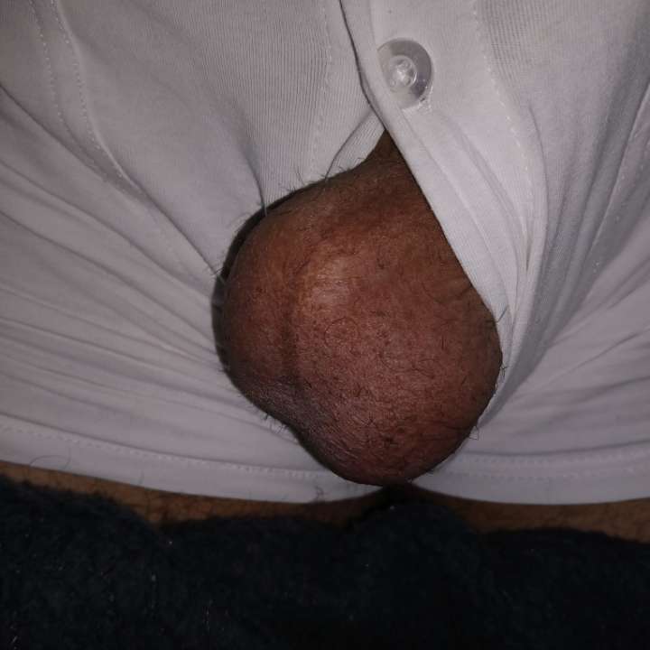 These balls are mouthwatering 🤤