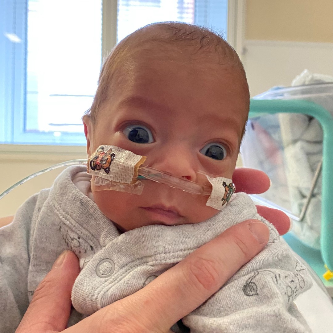 NHSEngland's tweet photo. Born at 26 weeks, weighing just 1lb 9.7oz, Ian’s journey began with an emergency transfer to @ImperialNHS.  

After 99 days in neonatal care, he went home - oxygen-free - just a day before his due date. A few months ago, Ian celebrated his 1st birthday! 

💙 https://t.co/I4XwIaTGia