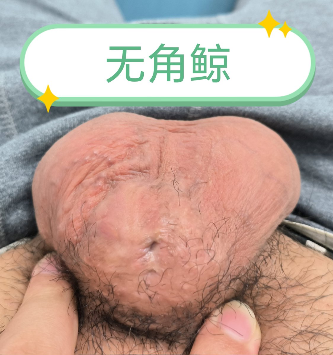 无角鲸 tweet media
