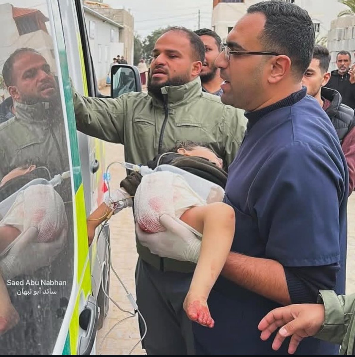EyeonPalestine's tweet photo. A child was injured in an Israeli air strike in the Nusairat refugee camp, central Gaza Strip. https://t.co/ZnGro07OMc