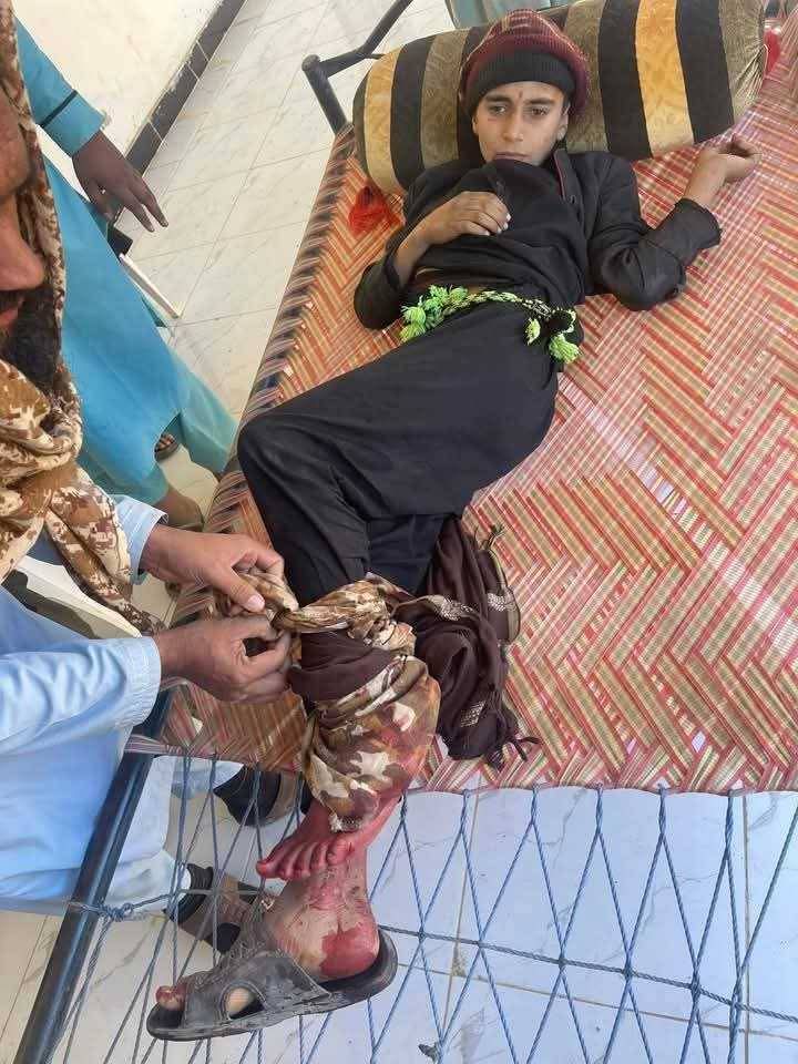 WaziristanFirst's tweet photo. میرعلی کے خیسور کرکنڑموم میں کواڈ کاپٹر کے حملے سے زخمی ہونے والے دہشتگرد،جو اے پی ایس پشاور اور نائن ایلیون حملوں میں ملوث تھے۔
چھوٹے موٹے طالبان کی تلاش میں ہمارے معصوم لوگ آئے روز مررہے ہیں اور بڑے بڑے طالبان کو پوری صوبائی حکومت دی گئی ہے۔ https://t.co/QBhpayB147
