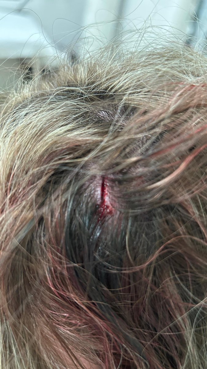 Jpn7_'s tweet photo. @UTRERAWeb Buenos días 

Me podrían ayudar donde puedo denunciar que se tiró en las cabalgatas cosas peligrosas?
Mi pareja acabo con una brecha en la cabeza y 5 puntos debido a algo que tiraron , solo tenemos constancia de que en la ambulancia tomaron datos.
@CiudadUtrera había niños tmb!! https://t.co/xqXUbIEpRd