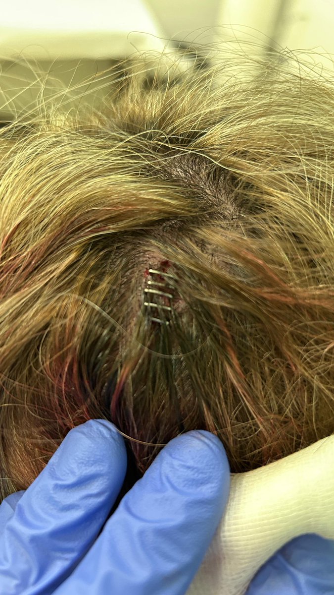 Jpn7_'s tweet photo. @UTRERAWeb Buenos días 

Me podrían ayudar donde puedo denunciar que se tiró en las cabalgatas cosas peligrosas?
Mi pareja acabo con una brecha en la cabeza y 5 puntos debido a algo que tiraron , solo tenemos constancia de que en la ambulancia tomaron datos.
@CiudadUtrera había niños tmb!! https://t.co/xqXUbIEpRd