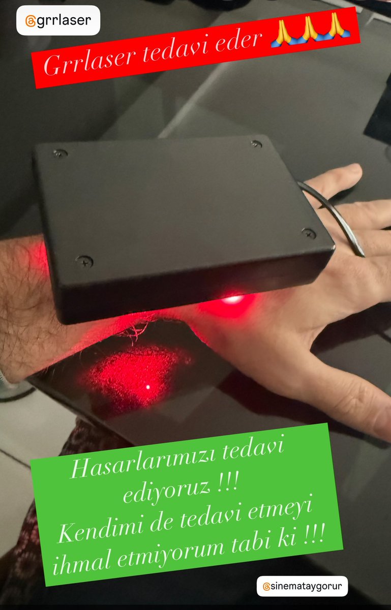 digorur's tweet photo. #grrlaser iyileştirir !! https://t.co/I4klwzWW7Y