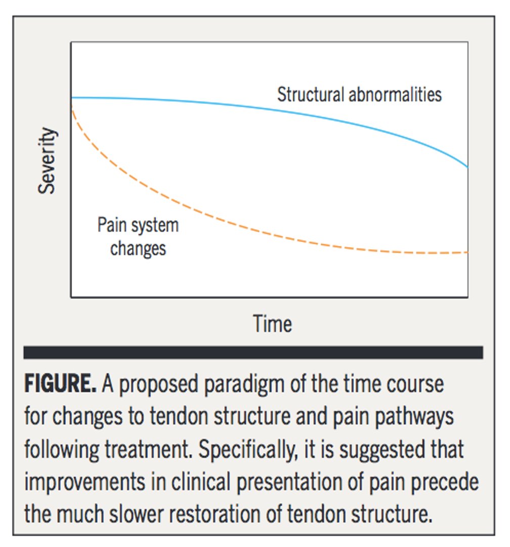 Just a reminder that tendon structure and pain don't have a simple relationship!

"Should We Care About Tendon Structure? The Disconnect Between Structure and Symptoms in Tendinopathy"

pubmed.ncbi.nlm.nih.gov/27136287/