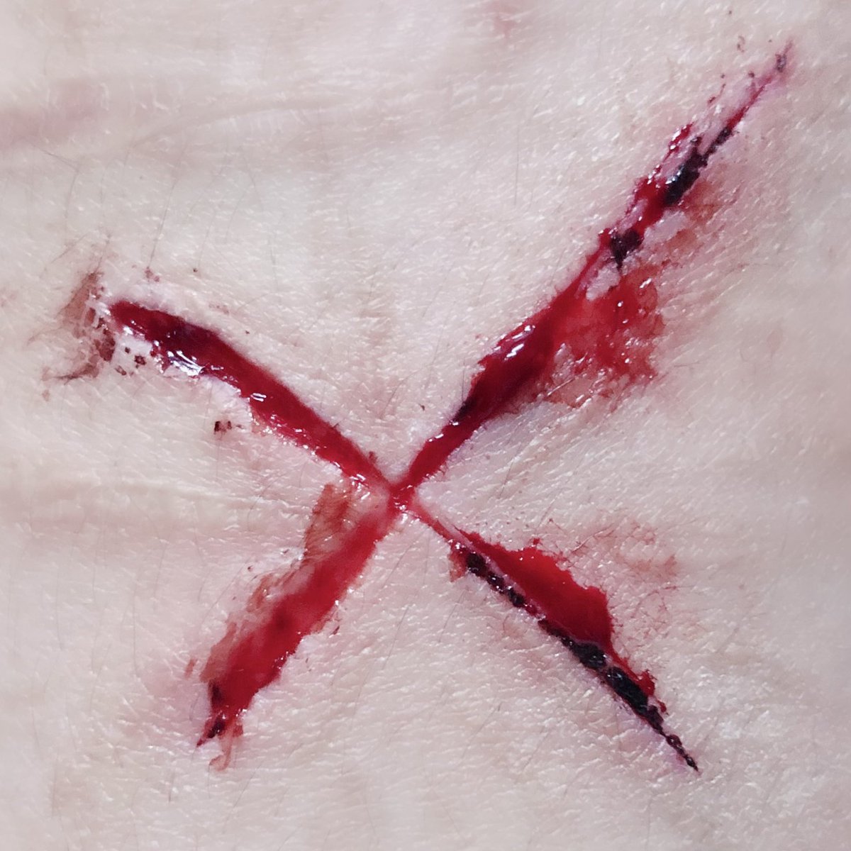 Misakaaa0502's tweet photo. ❌❌❌

#自傷 #自殘 #自傷行為 #自殘行為 #紫餐 #selfharm #抑鬱症 https://t.co/h7jnNgpVDB