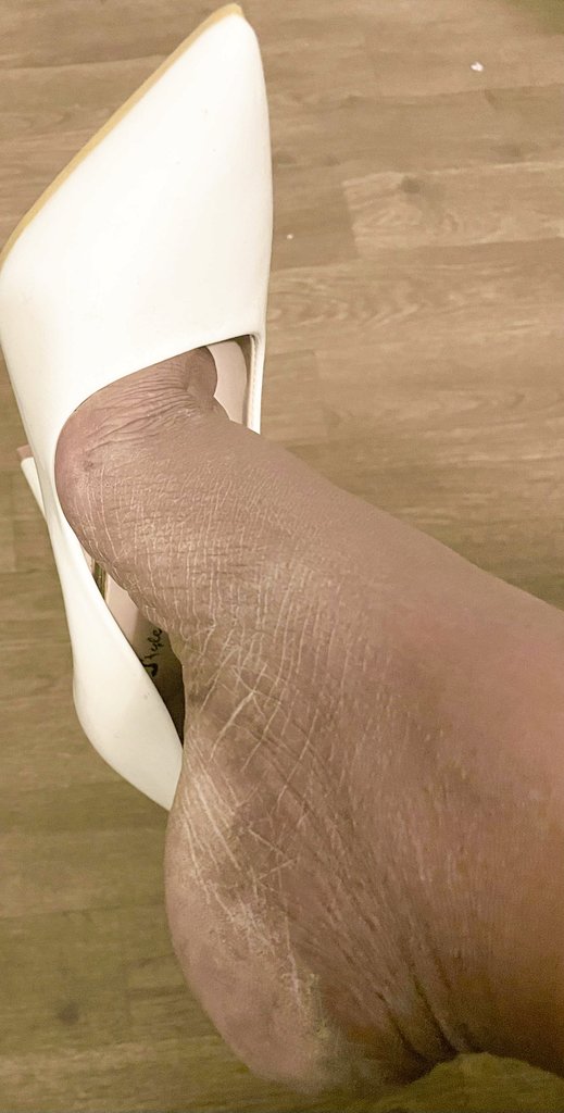 AsmrPrettyfeet's tweet photo. #dryfootheels
#dryfoot
#ashyheels
#dangle
#findom
#prettyfeet https://t.co/9LXVNElMNh
