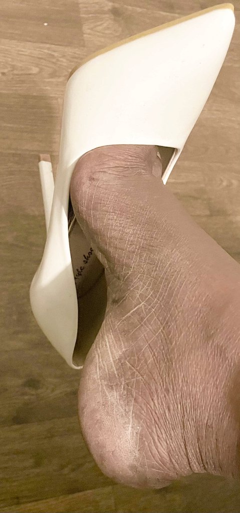AsmrPrettyfeet's tweet photo. #dryfootheels
#dryfoot
#ashyheels
#dangle
#findom
#prettyfeet https://t.co/9LXVNElMNh