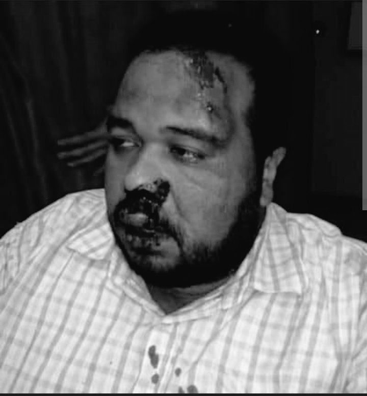 A éste mamaguevo de lara Farías no le bastó la coñaza que le dieron los adecos por JETON.