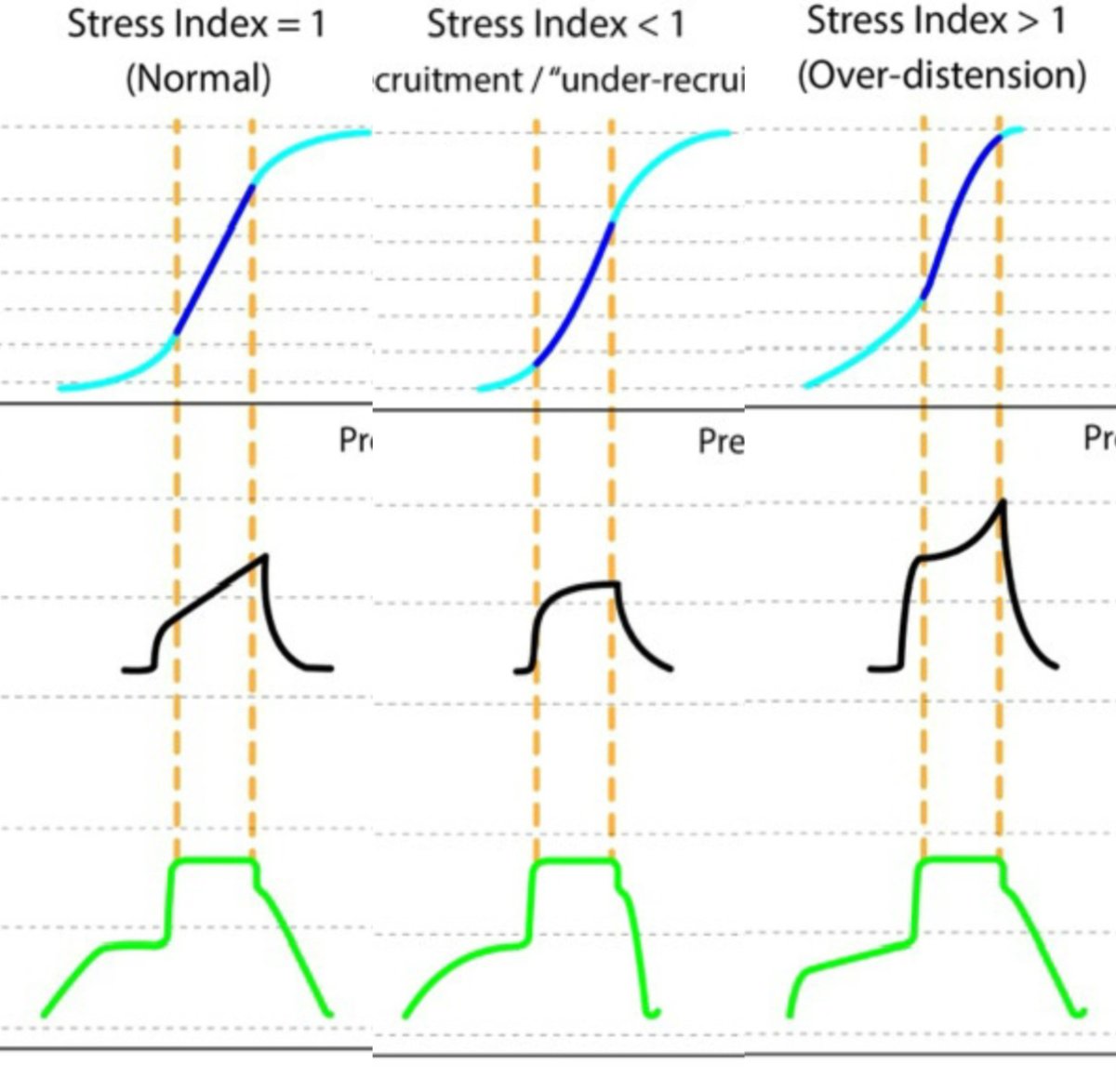 The ventilator stress index measures the stress and strain imposed on the respiratory system during mechanical ventilation. It is a useful tool in predicting the risk of VILI and guiding PEEP titration in critically ill patients. #mechanicalventilation
jcvaonline.com/article/S1053-…