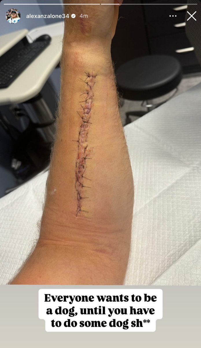 Alex Anzalone just posted this on his Instagram story 👀

“Everyone wants to be a dog, until you have to do some dog sh**”

HE’S READY FOR THE COMEBACK TODAY #OnePride