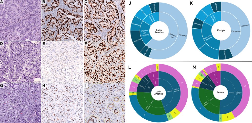 We are pleased to share part of our work <a href="/LegacyH2020/">LEGACyH2020</a> which reveals significant biological differences in gastric cancer between Europe and LATAM, centered on molecular type distribution, biomarker expression, cell cycle, and phenotypic attributes. 
doi.org/10.1007/s10120…