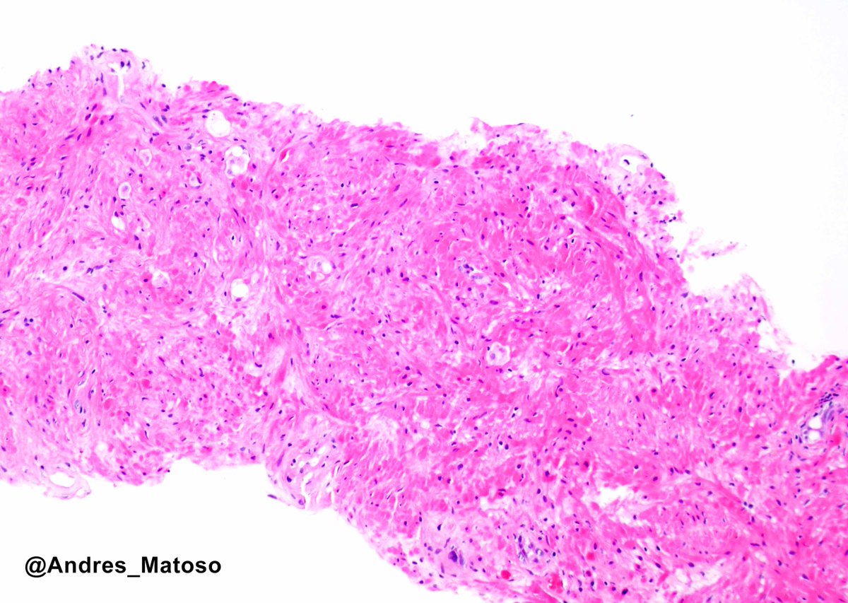 Andres Matoso tweet media