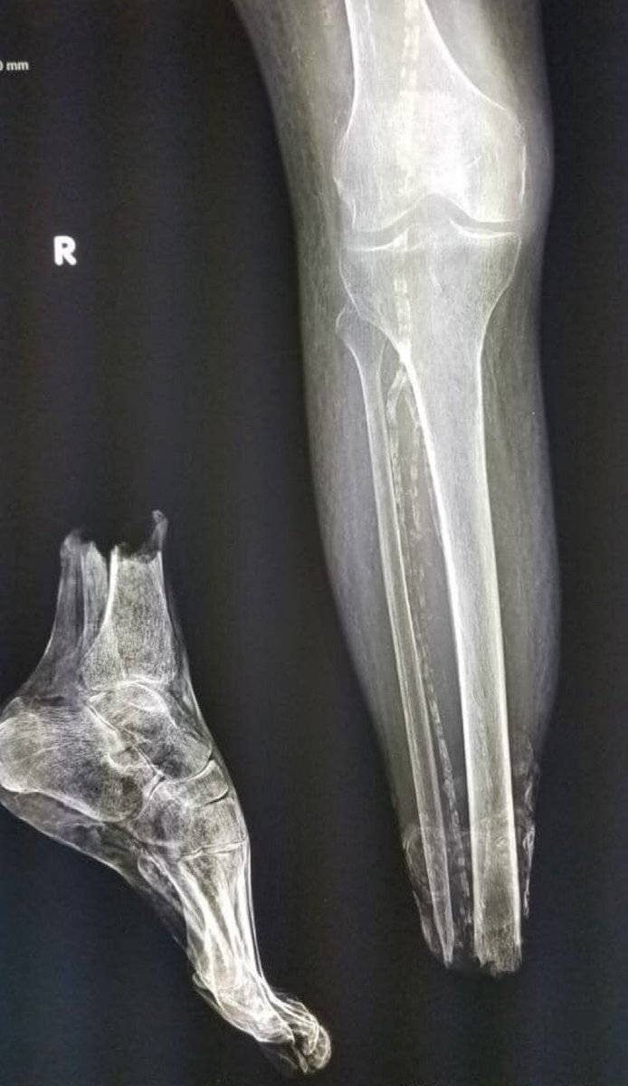 Sam Ghali, M.D. tweet media