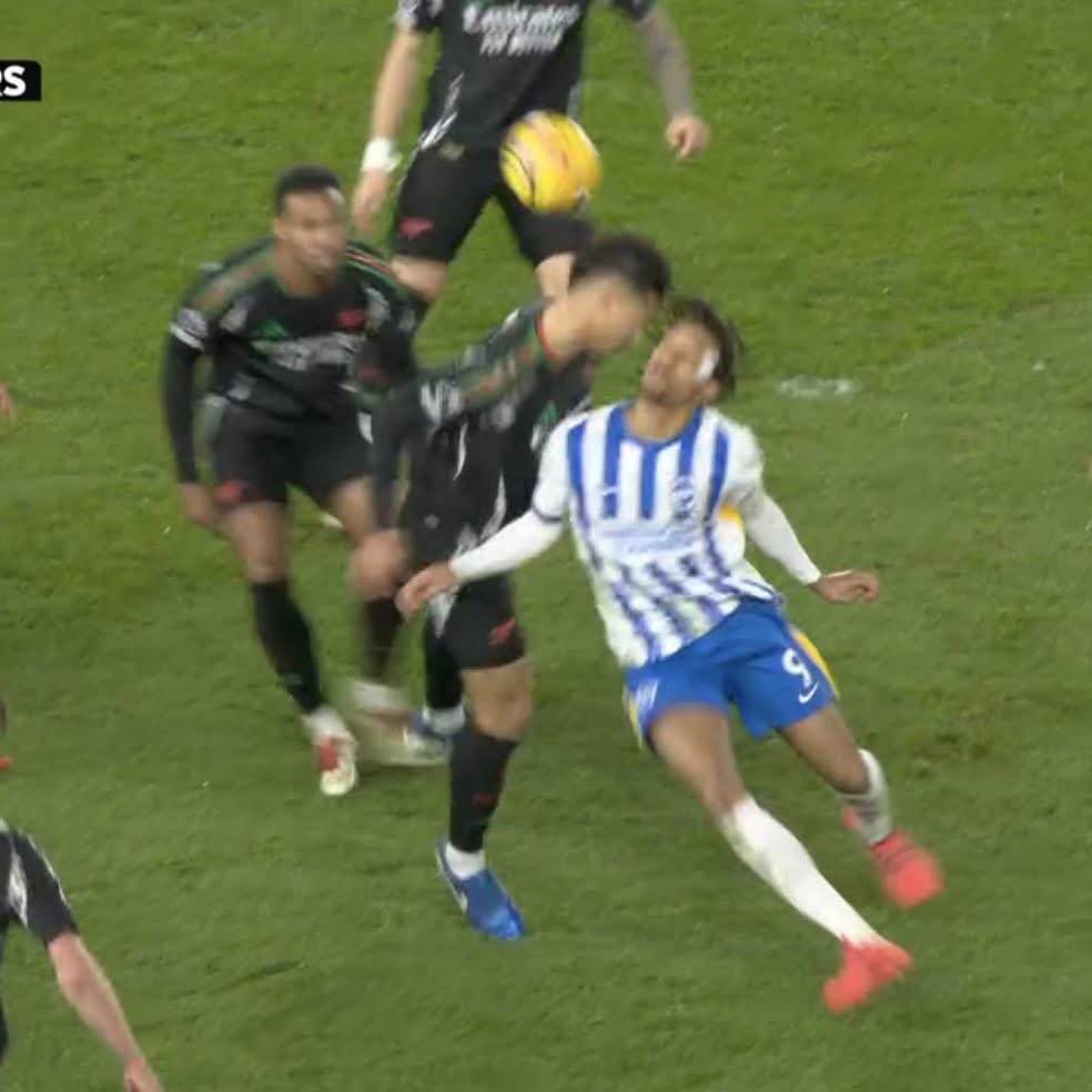 simonhuffer's tweet image. Joao Pedro’s blatant play acting, was SO cynical and pre-planned, that he even had the plaster already on his head BEFORE pretending Saliba had hit him…. #bhafc #afc