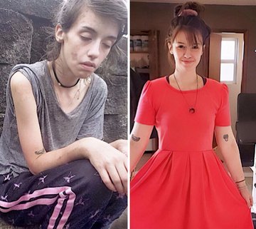 2. Venció a las drogas. 19 meses sin consumir y por fin empieza a ver de nuevo la belleza de la vida