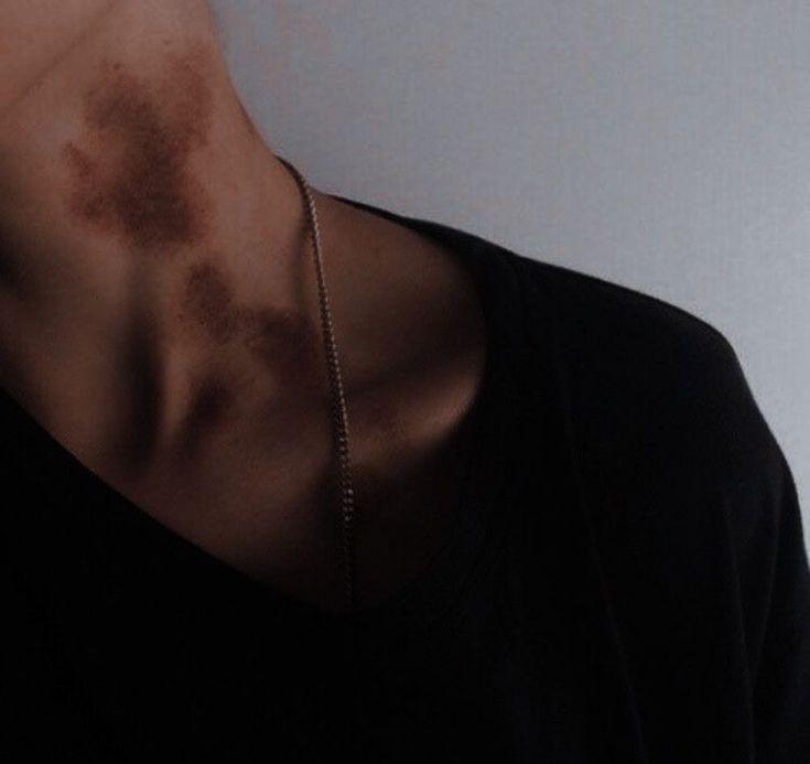 [TEXT TO: The Reader]
[IMAGE ATTACHED]

I told you to take it easy last night.