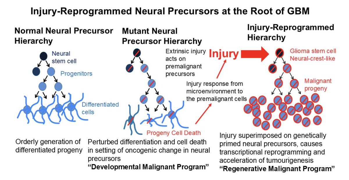 James Rutka (@jamesrutka) on Twitter photo This just out! My colleague Peter Dirks and his lab published on the origins of Glioblastoma from neural precursor cells in a manner similar to injury reprogramming. In <a href="/Nature/">nature</a> this week! #glioblastoma #stemcells <a href="/SickKidsNews/">The Hospital for Sick Children (SickKids)</a> <a href="/UofTSurgery/">U of T Department of Surgery</a> <a href="/UofTNeuroSurge/">University of Toronto Neurosurgery</a> This just out! My colleague Peter Dirks and his lab published on the origins of Glioblastoma from neural precursor cells in a manner similar to injury reprogramming. In <a href="/Nature/">nature</a> this week! #glioblastoma #stemcells <a href="/SickKidsNews/">The Hospital for Sick Children (SickKids)</a> <a href="/UofTSurgery/">U of T Department of Surgery</a> <a href="/UofTNeuroSurge/">University of Toronto Neurosurgery</a>