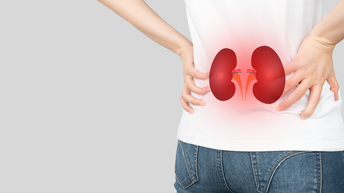 Insel Gruppe (@inselgruppe) on Twitter photo Exciting Bern Kidney Stone News: The diabetes drug empagliflozin significantly reduced kidney stone formation in the SWEETSTONE study led by #InselGroup & <a href="/unibern/">UniversitĂ€t Bern</a>. More: nature.com/articles/s4159âŠ
<a href="/Dan_Fuster/">Daniel G. Fuster</a>
<a href="/Andereggman/">Manuel Anderegg</a>
<a href="/MedFacultyUniBE/">Faculty of Medicine, University of Bern</a> Exciting Bern Kidney Stone News: The diabetes drug empagliflozin significantly reduced kidney stone formation in the SWEETSTONE study led by #InselGroup & <a href="/unibern/">UniversitĂ€t Bern</a>. More: nature.com/articles/s4159âŠ
<a href="/Dan_Fuster/">Daniel G. Fuster</a>
<a href="/Andereggman/">Manuel Anderegg</a>
<a href="/MedFacultyUniBE/">Faculty of Medicine, University of Bern</a>