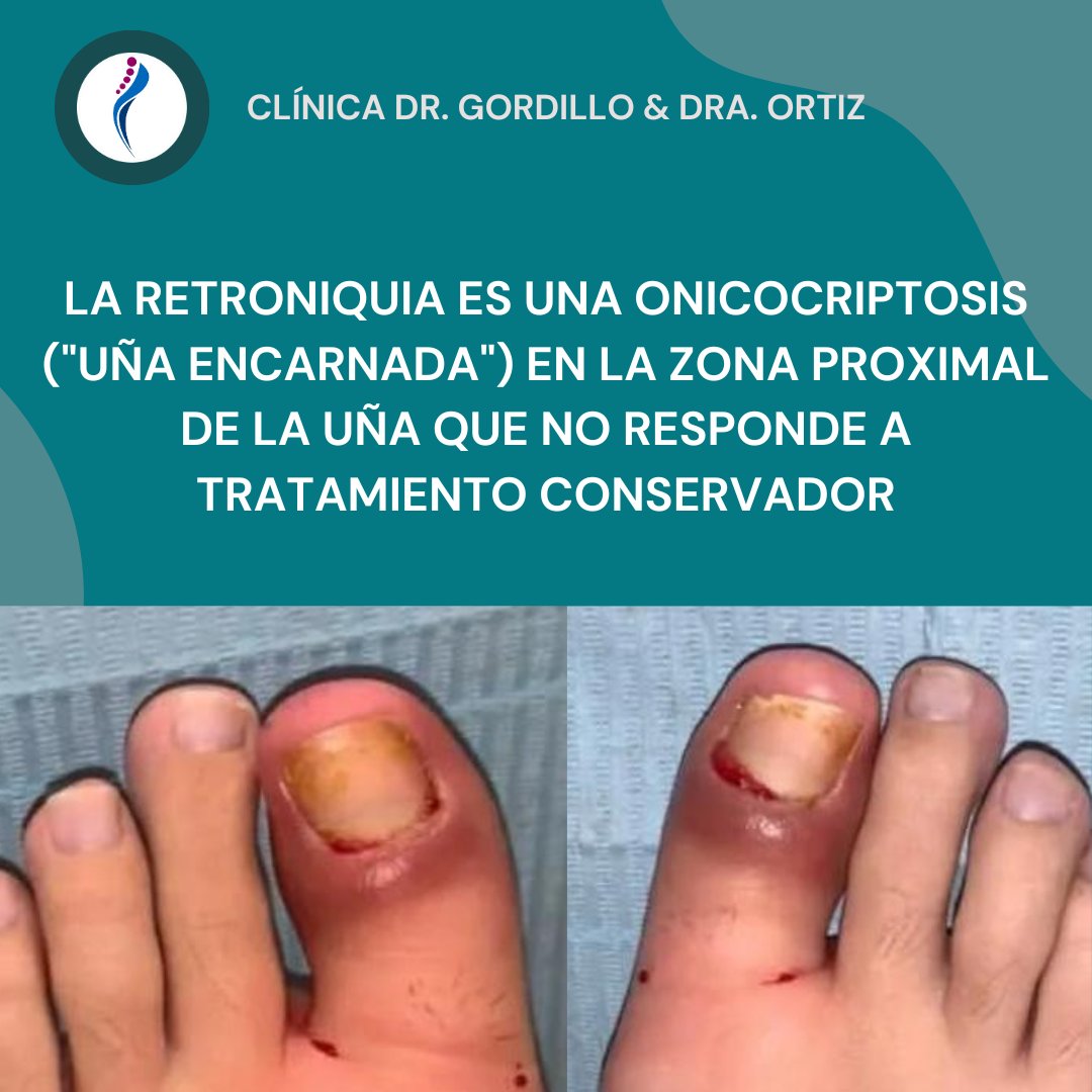 DoctoresDelPie's tweet photo. 🦶 https://t.co/wTCkocyk0v
