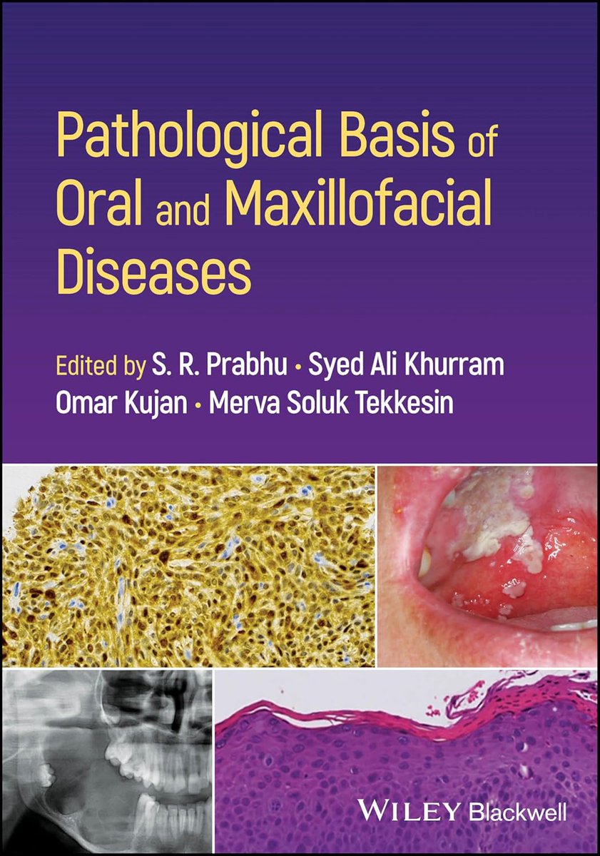 Ali Khurram (@sakhurram) on Twitter photo Kicking off 2025 with fantastic news- Our book, Pathological basis of Oral & Maxillofacial Diseases, is published and available for purchase!
Big thanks to Ram Prabhu, my fellow co-editors <a href="/Omark8867/">Omar Kujan</a>, <a href="/merva_st/">Merva Soluk Tekkesin</a> & contributors around the globe.
shorturl.at/avAMt Kicking off 2025 with fantastic news- Our book, Pathological basis of Oral & Maxillofacial Diseases, is published and available for purchase!
Big thanks to Ram Prabhu, my fellow co-editors <a href="/Omark8867/">Omar Kujan</a>, <a href="/merva_st/">Merva Soluk Tekkesin</a> & contributors around the globe.
shorturl.at/avAMt