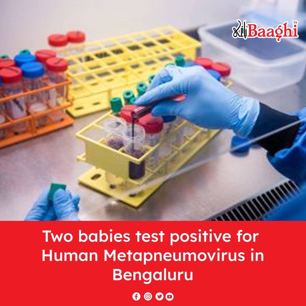 BaaghiTV's tweet photo. Two babies test positive for Human Metapneumovirus in Bengaluru
https://t.co/8omiHdrD4O
#BaaghiTV #HumanMetapneumovirus #Bengaluru #TwoBabies #TestPositive https://t.co/RonsE8xuD1