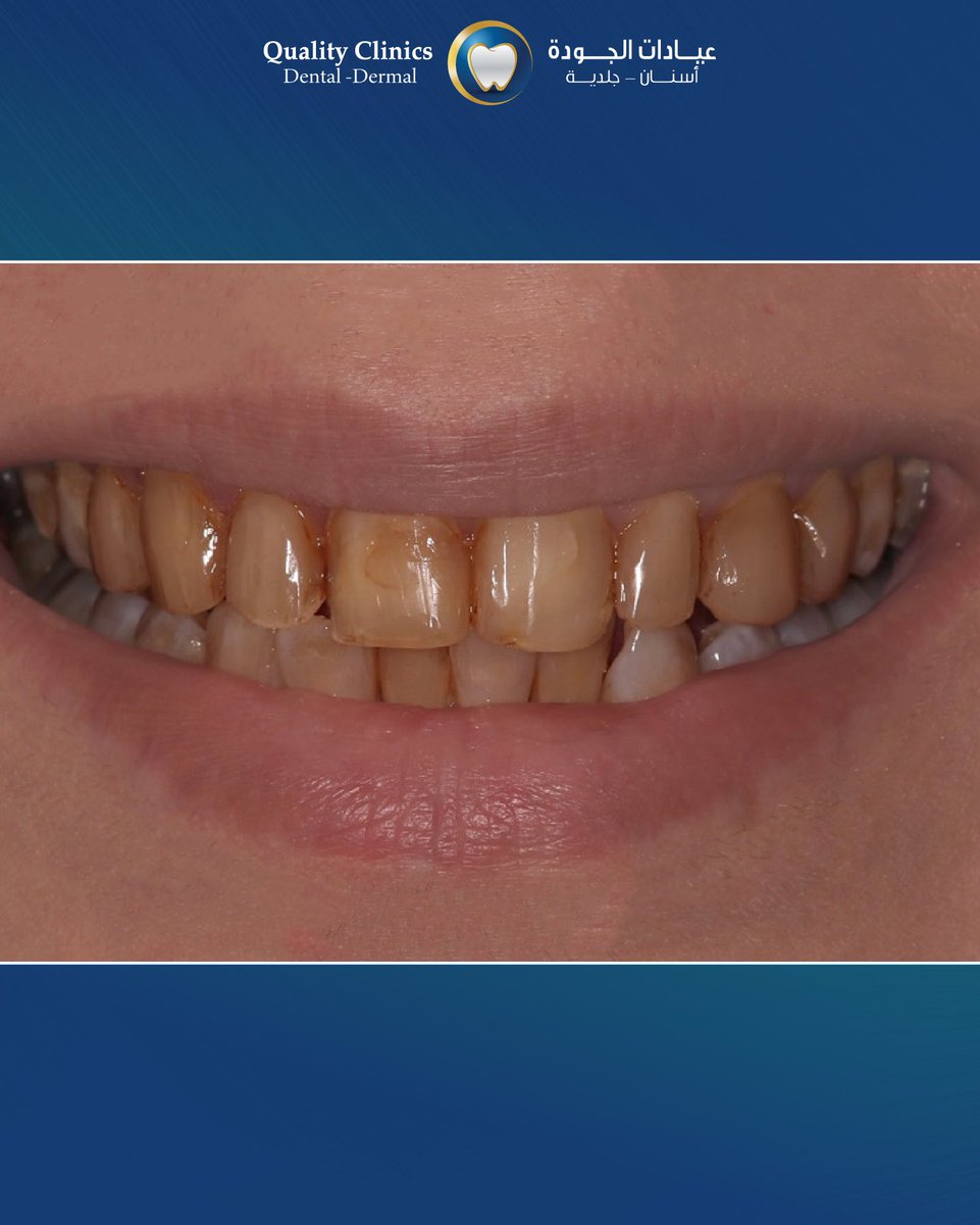 عيادات الجودة | Aljawdah Clinics tweet media