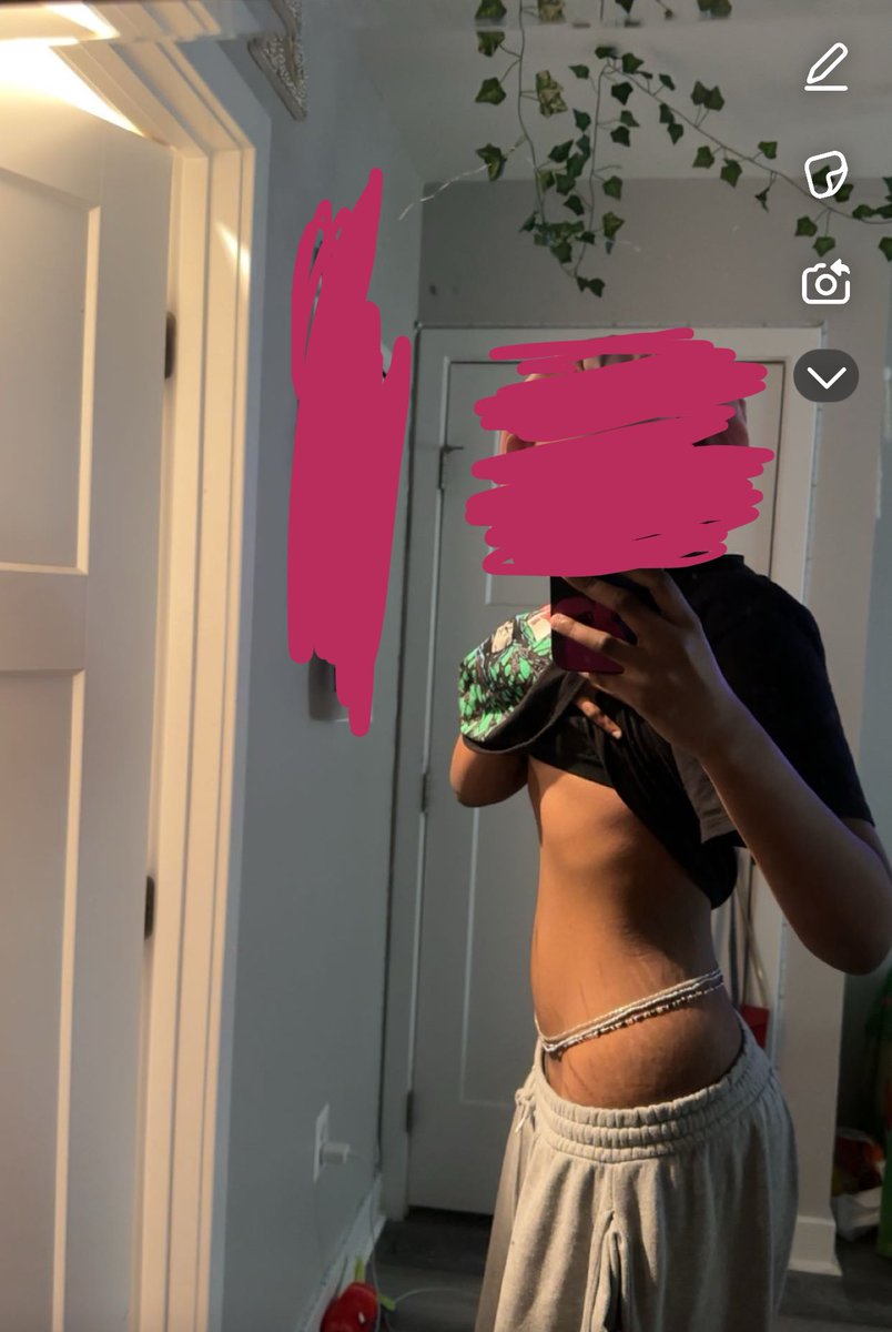 one year apart guys don’t give up 💗💗