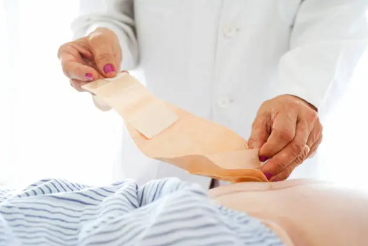 MediTechInsight's tweet photo. The global ostomy devices market is projected to grow at a CAGR of 4-6% over the next five years. π
π Download the sample report: https://t.co/m1nYHyFqAN
#OstomyCare #OstomyDevices #OstomyIndustry #OstomyCareProducts #StomaCare #OstomySupport #HealthcareMarket https://t.co/OAR41aYtD9