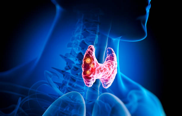 Impaired thyroid function has become a pandemic and is one of the main drivers behind symptoms such as:

• Hair loss
• Brain fog
• Low libido
• Chronic fatigue
• High LDL
• Overall hormonal imbalances
• Depression
• Gut issues

Here's what you need to know.
Thread🧵