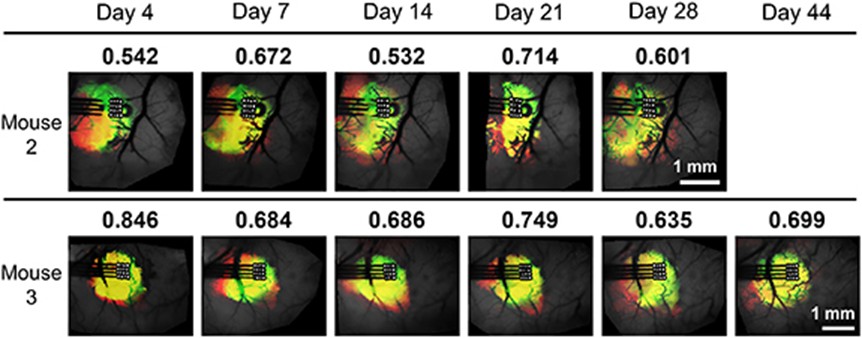 BIONIC_Lab's tweet photo. New Paper: University of Pittsburgh Neural Engineering shows spatial variability in Ca imaging-ePhys correlation after electrode implantation. Early injury response increases neuronal synchrony, but diverse cortical responses emerge over time. #Neuroscience #Neurotech #CaImaging https://t.co/GnAbBXI6Zp