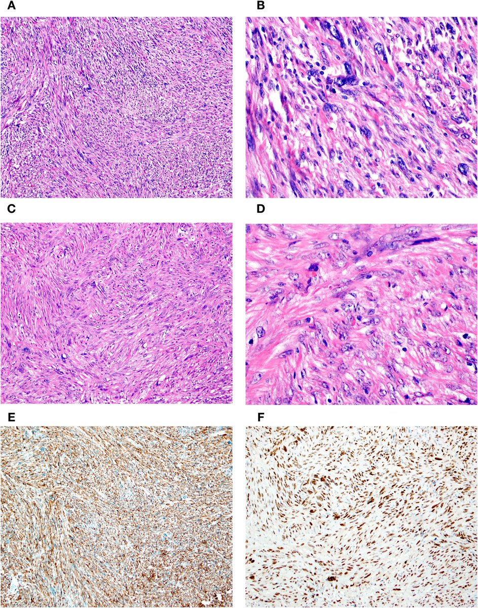 Human Pathology tweet media