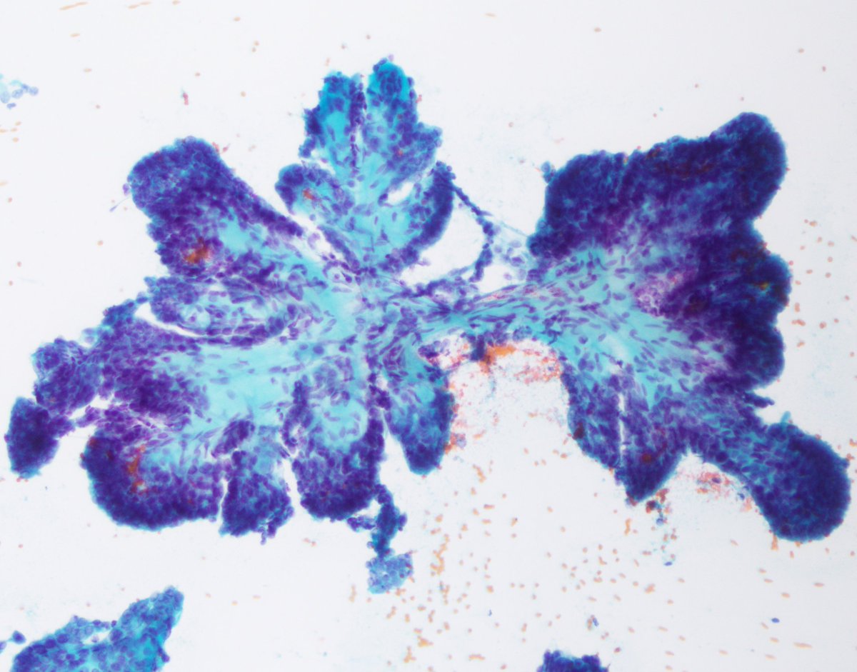 Vanda Torous MD tweet media