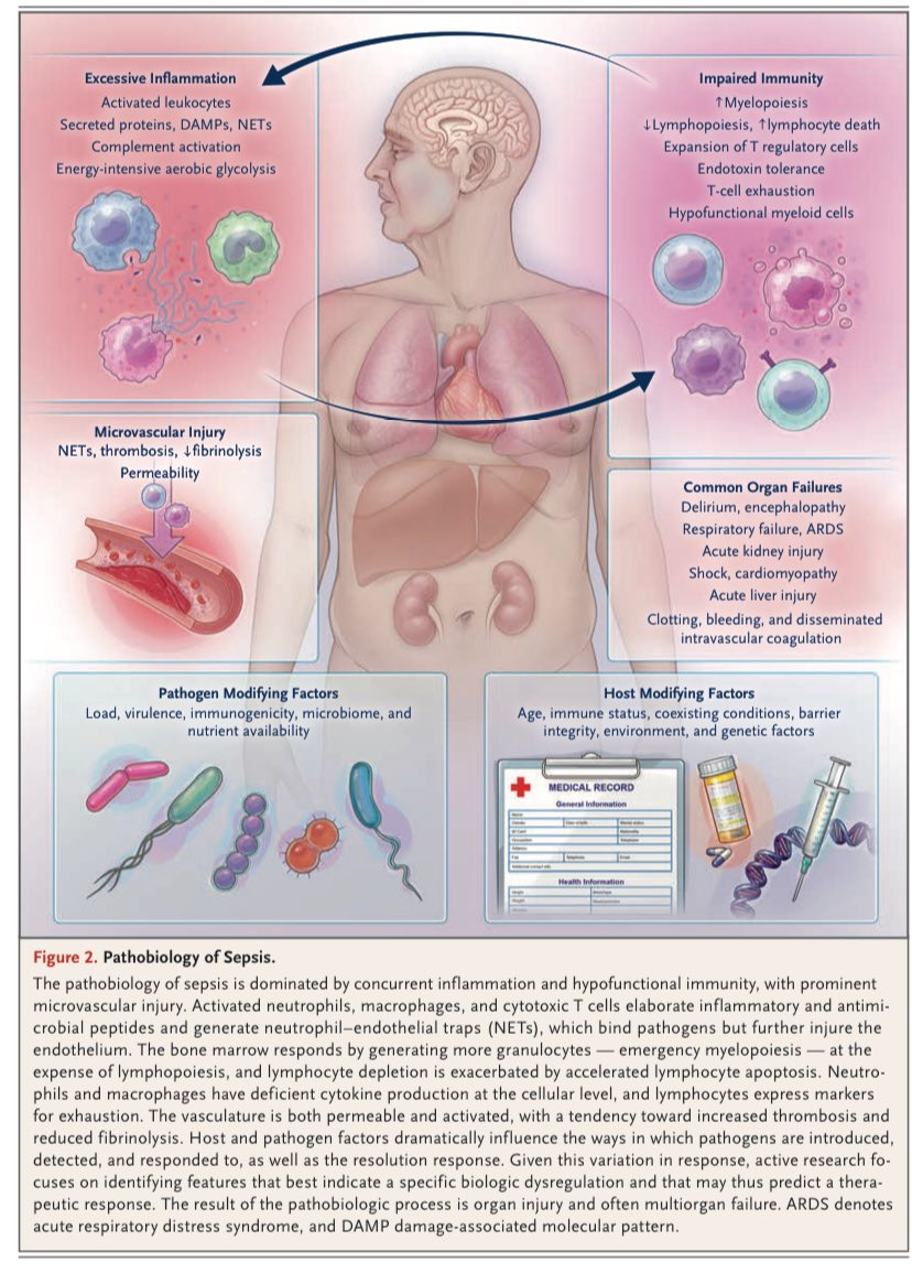 Vanessa S. Lanziotti (@vslanziotti) on Twitter photo Nice & wide #review about #sepsis & septic shock <a href="/NEJM/">NEJM</a> (from dec 2024)
✅Epidemiology
✅Biologic features
✅Clinical Presentation &Evaluation
✅Management
✅Research
nejm.org/doi/full/10.10…
#PedsICU #MedEd #FOAMed #FoaMcc
<a href="/rjabornisky/">Roberto Jabornisky</a> <a href="/EndSepsis/">END SEPSIS</a> <a href="/SepsisAlliance/">Sepsis Alliance</a> <a href="/danicds72/">Daniela Souza</a> Nice & wide #review about #sepsis & septic shock <a href="/NEJM/">NEJM</a> (from dec 2024)
✅Epidemiology
✅Biologic features
✅Clinical Presentation &Evaluation
✅Management
✅Research
nejm.org/doi/full/10.10…
#PedsICU #MedEd #FOAMed #FoaMcc
<a href="/rjabornisky/">Roberto Jabornisky</a> <a href="/EndSepsis/">END SEPSIS</a> <a href="/SepsisAlliance/">Sepsis Alliance</a> <a href="/danicds72/">Daniela Souza</a>