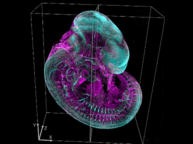 Biomedical Picture of the Day BPoD (@bpod_s) on Twitter photo Improving contrast & resolution of fluorescence microscopy by compensating aberrations with a deep learning approach
📷: Min Guo et al <a href="/ZJU_China/">Zhejiang University</a> <a href="/NIBIBgov/">NIBIB</a> in <a href="/NatureComms/">Nature Communications</a>
➡️: bpod.org.uk/archive/2025/1… Improving contrast & resolution of fluorescence microscopy by compensating aberrations with a deep learning approach
📷: Min Guo et al <a href="/ZJU_China/">Zhejiang University</a> <a href="/NIBIBgov/">NIBIB</a> in <a href="/NatureComms/">Nature Communications</a>
➡️: bpod.org.uk/archive/2025/1…