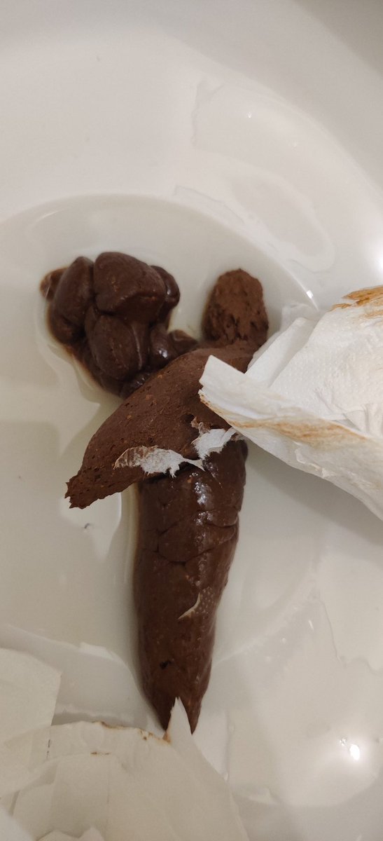 Mund auf und schlucken❗❗❗ Wer will sich eine Ladung bestellen? Gerne PN. 😈😈

#scat #scatfetish #scatcommunity #poopfetish #poop #stinky #gassy #femdom #findom