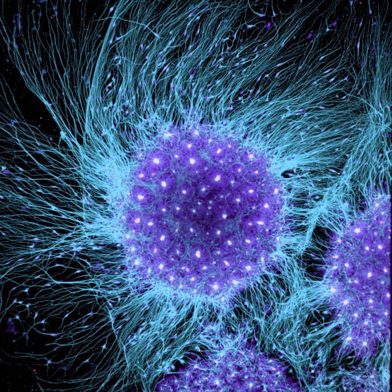 microscopic view of human neurons