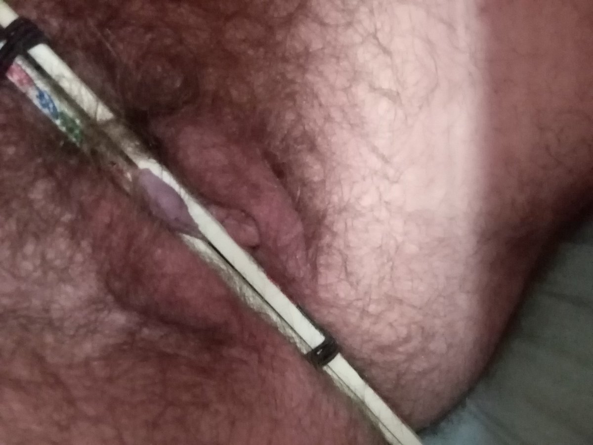 AngelicDenial's tweet photo. extremely rare photo of tiny tortured nub https://t.co/Qv9BA1tYhA