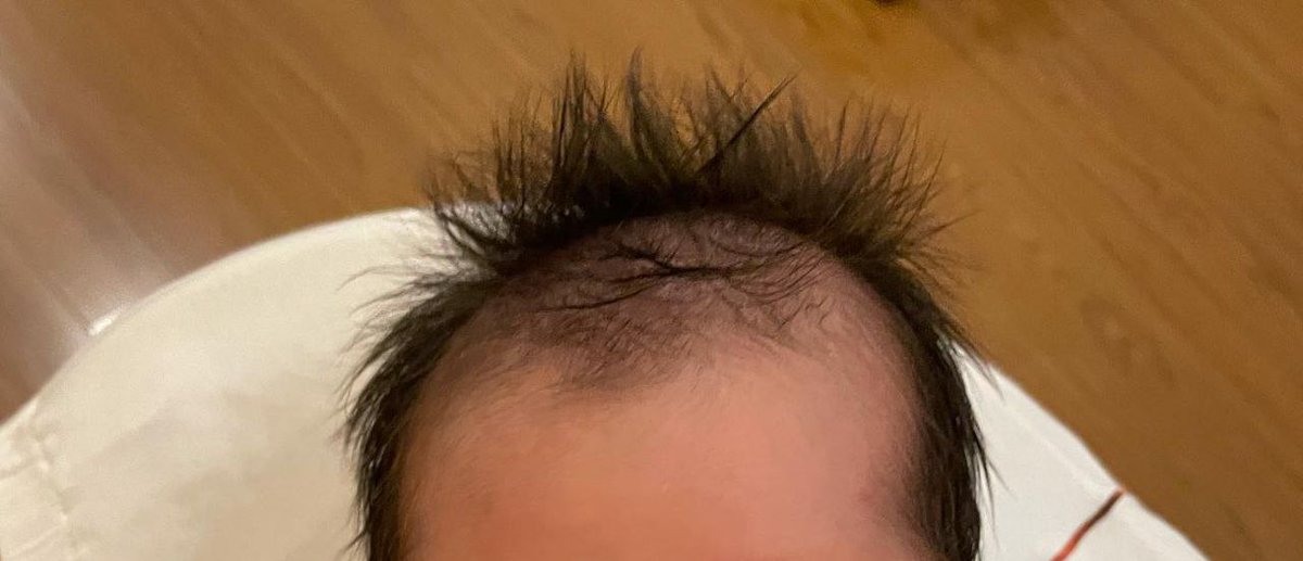 Agora eu entendo como é a sensação de carregar um filho por 9 meses na barriga pra ele nascer igual ao pai.

Meu filho nasceu calvo.