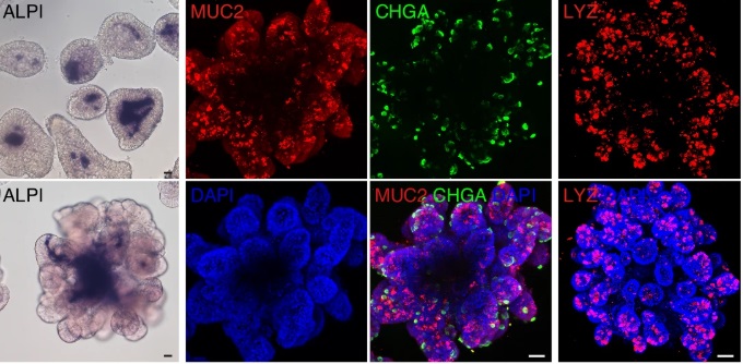 organoidscience's tweet photo. 📢 New in @NatureComms!
Researchers have established a tunable human #IntestinalOrganoid system that achieves a controlled balance between self-renewal and differentiation.
Learn how: https://t.co/bVraHaEBgg https://t.co/oATniHmudV