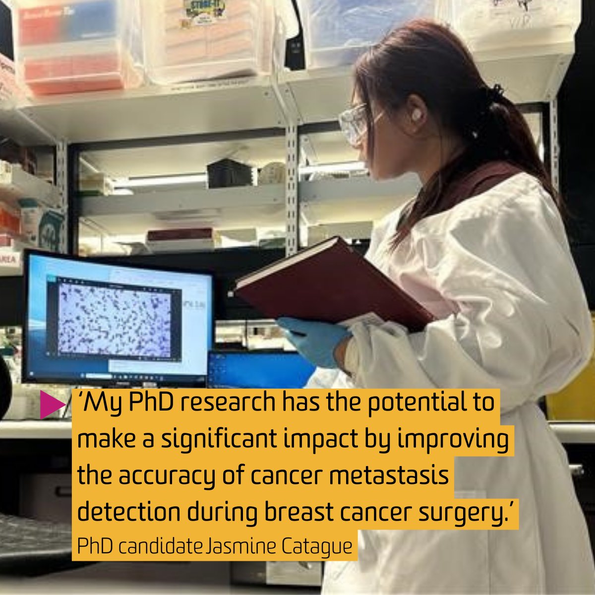 IMPACT (@impactdeakin) on Twitter photo Jasmine Catague’s research is transforming breast cancer surgery by developing a real-time method to detect cancer metastasis. Her work aims to improve outcomes, reduce follow-up surgeries, and lower recurrence risks. Read more: deakin.au/4acNHcn Jasmine Catague’s research is transforming breast cancer surgery by developing a real-time method to detect cancer metastasis. Her work aims to improve outcomes, reduce follow-up surgeries, and lower recurrence risks. Read more: deakin.au/4acNHcn