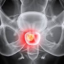 AuntMinnie's tweet photo. PSMA-PET imaging spiked after FDA approval #radiology @VAAnnArbor https://t.co/b2a971G5Aq https://t.co/XmttfgqqQc