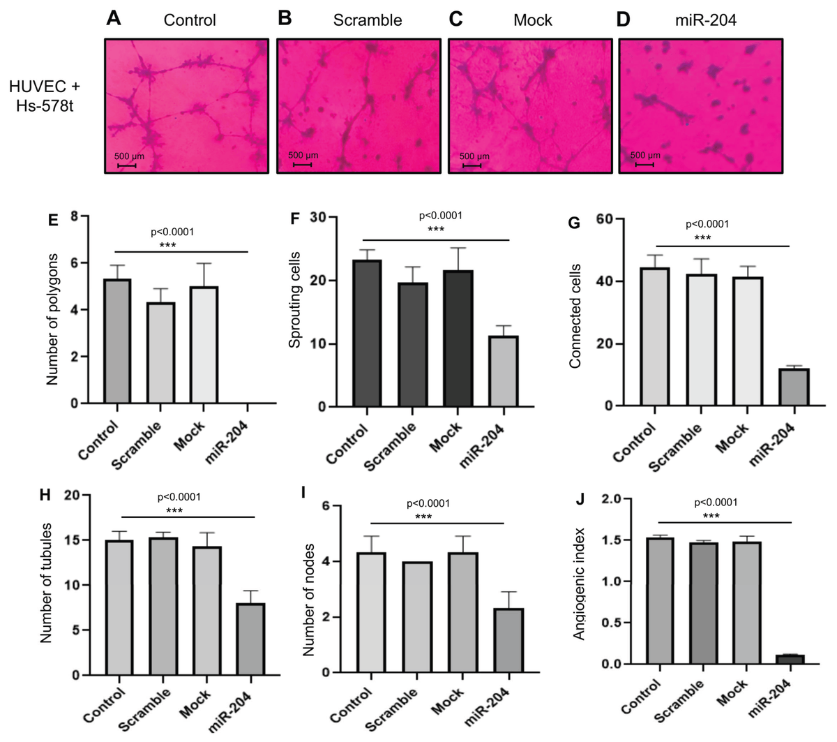 Non_Coding_RNA's tweet image. 🌟Presenting Our Article Paper🌟

"#MicroRNA-204 Regulates Angiogenesis and Vasculogenic Mimicry in CD44+/CD24− Breast #Cancer Stem-like #Cells" from Martha Resendiz-Hernández et al.
#ncRNA @MDPIOpenAccess 

Full text: mdpi.com/2311-553X/10/1…