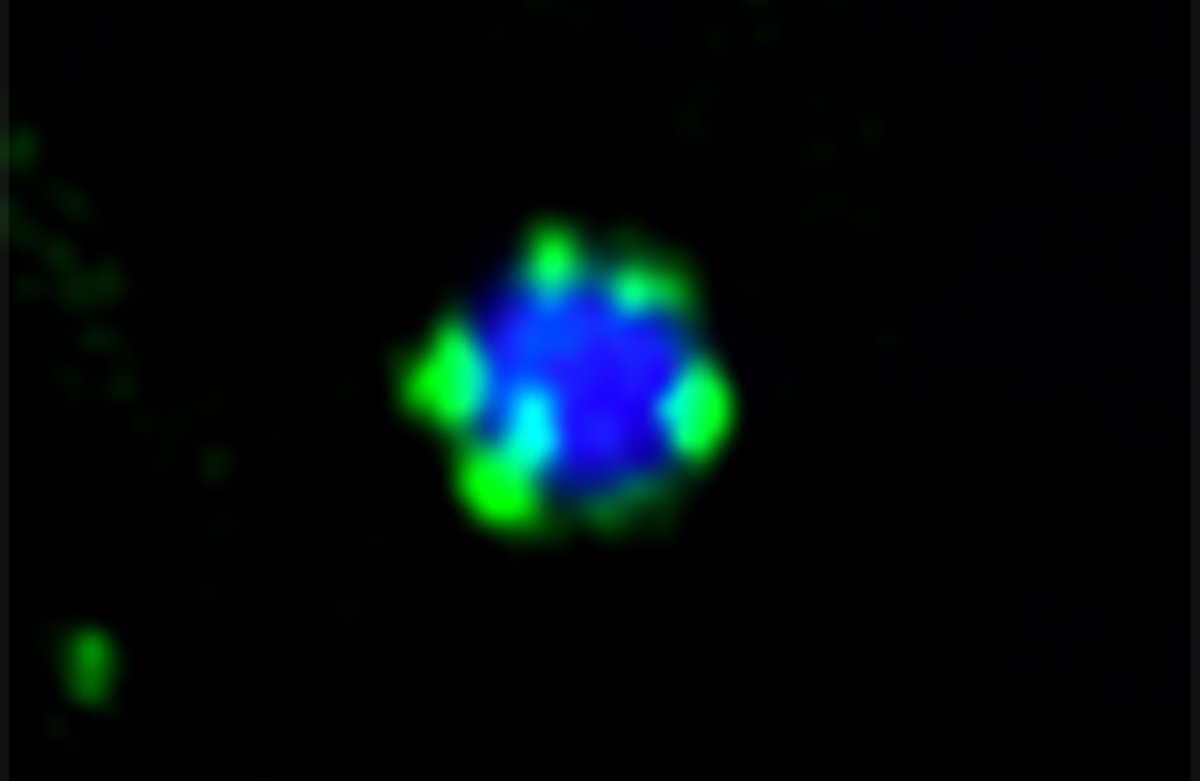 Universität Freiburg (@unifreiburg) on Twitter photo Wie entsorgen Zellen Abfall? Forschende aus Freiburg <a href="/KraftLabFR/">Kraft Lab</a> <a href="/CIBSS_UniFR/">CIBSS</a> & Frankfurt <a href="/WilflingLab/">The Wilfling Lab</a> zeigen in <a href="/NatureCellBio/">Nature Cell Biology</a>, wie schwache Molekül-Wechselwirkungen #Autophagie auslösen – ein möglicher Schlüssel für die Forschung zu #Alzheimer & #Krebs. ufr.link/cibss-autophag… Wie entsorgen Zellen Abfall? Forschende aus Freiburg <a href="/KraftLabFR/">Kraft Lab</a> <a href="/CIBSS_UniFR/">CIBSS</a> & Frankfurt <a href="/WilflingLab/">The Wilfling Lab</a> zeigen in <a href="/NatureCellBio/">Nature Cell Biology</a>, wie schwache Molekül-Wechselwirkungen #Autophagie auslösen – ein möglicher Schlüssel für die Forschung zu #Alzheimer & #Krebs. ufr.link/cibss-autophag…