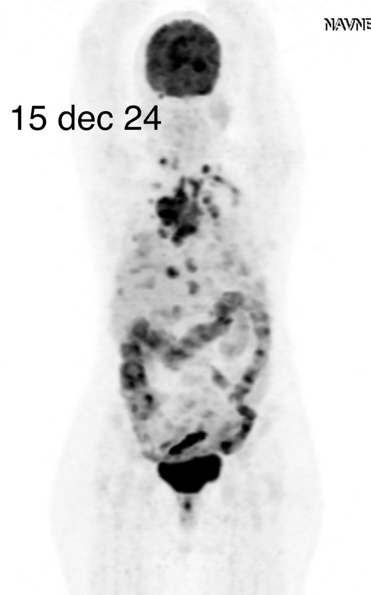 Nirmal Raut tweet media