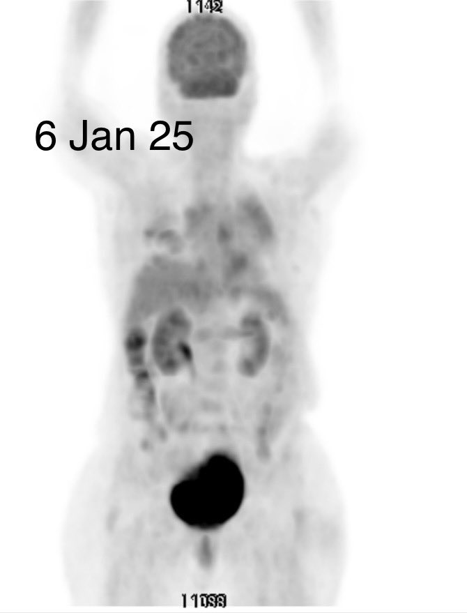 Nirmal Raut tweet media