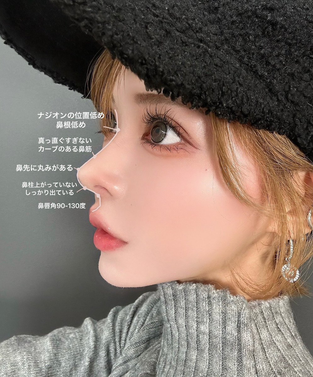 鼻形成術 \u003d Aesthetic Rhinoplasty : 美容外科手術手技 鼻形成術 \u003d Aesthetic Rhinoplasty : 美容外科, image size:995x1200