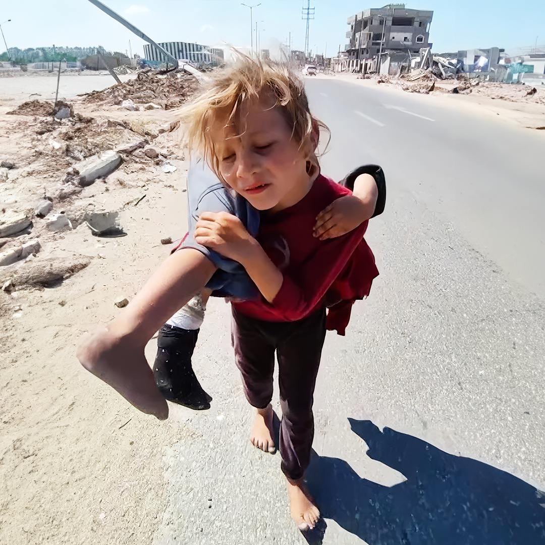 “I carried her because she couldn’t walk.”

With Sumaya in need of treatment and unable to walk, Qamar slung her younger sister over her shoulders and carried her to the hospital. With no ambulances to take them home, Qamar picked her sister up again and walked barefoot in the