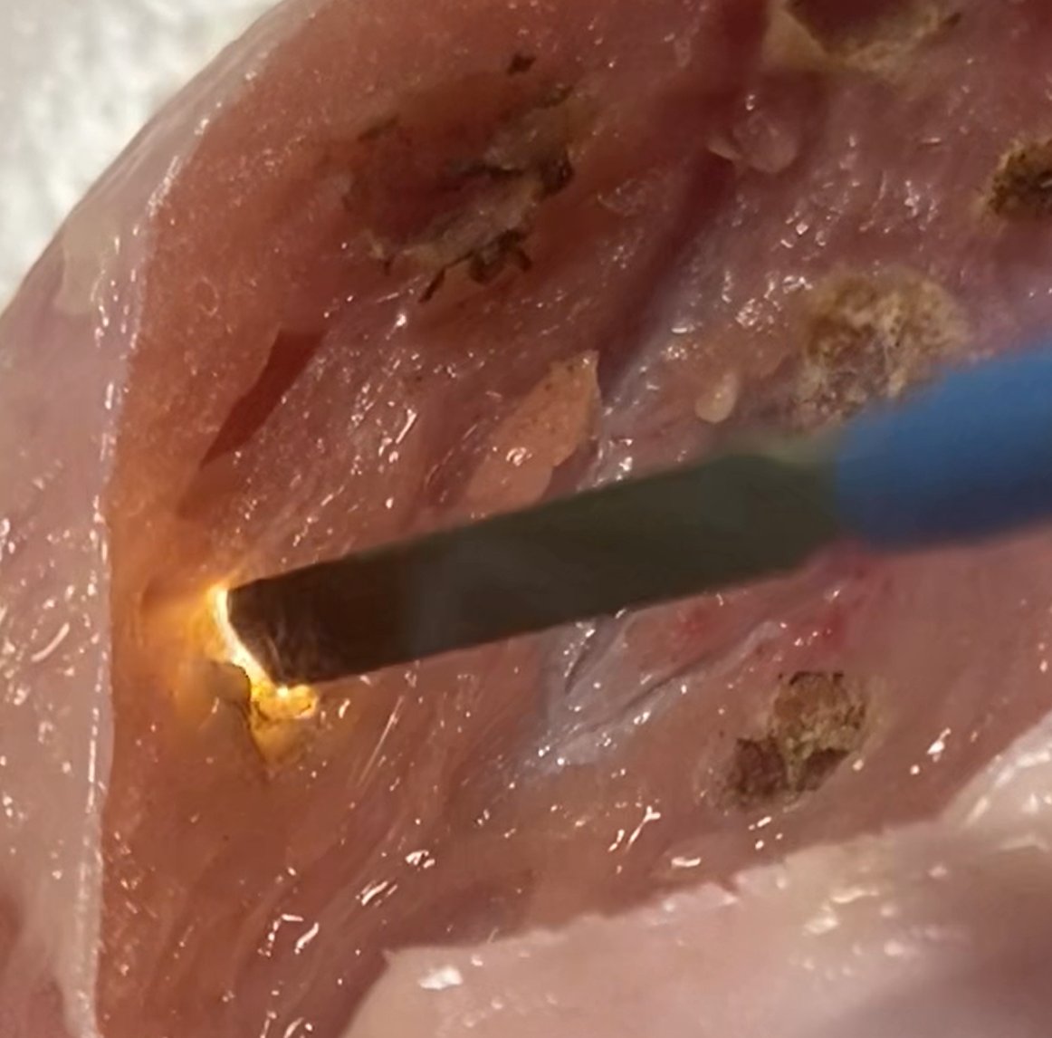 Ron Barbosa MD FACS tweet media