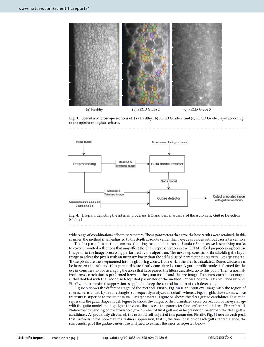 WooptixCorp's tweet image. ✨Fuchs’ Endothelial Corneal Dystrophy evaluation using a high-resolution wavefront sensor✨

Wooptix has developed a device that allows observation inside the eyeball with unprecedented resolution.

Discover all paper here: wooptix.com/1735573161625/

#WavefrontSensor #WFPI